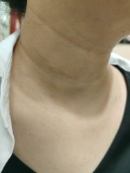-北京美痣堂古方祛痣斑疣瘊