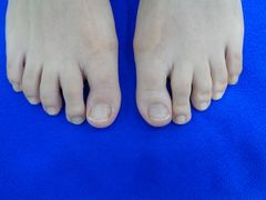 -世龙世家甲沟炎·灰指甲·嵌甲矫正·修脚(武侯区双楠店)