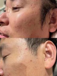 点击看大图 -美肤盾祛痘·问题肌头疗管理中心