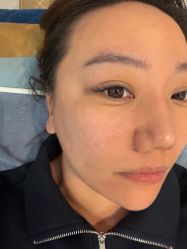 -More摩尔医美の注射线雕光电中心