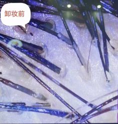 点击看大图 -侗秀养发•头疗