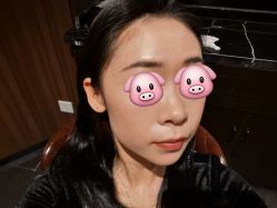 体验前-上海首尔丽格医疗美容医院