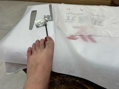 -郑远元专业修脚房(文三路九莲新村店)