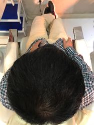 -大麦微针植发全国连锁