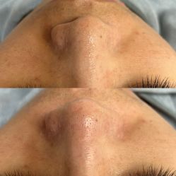 -Cream88颜皮肤管理中心