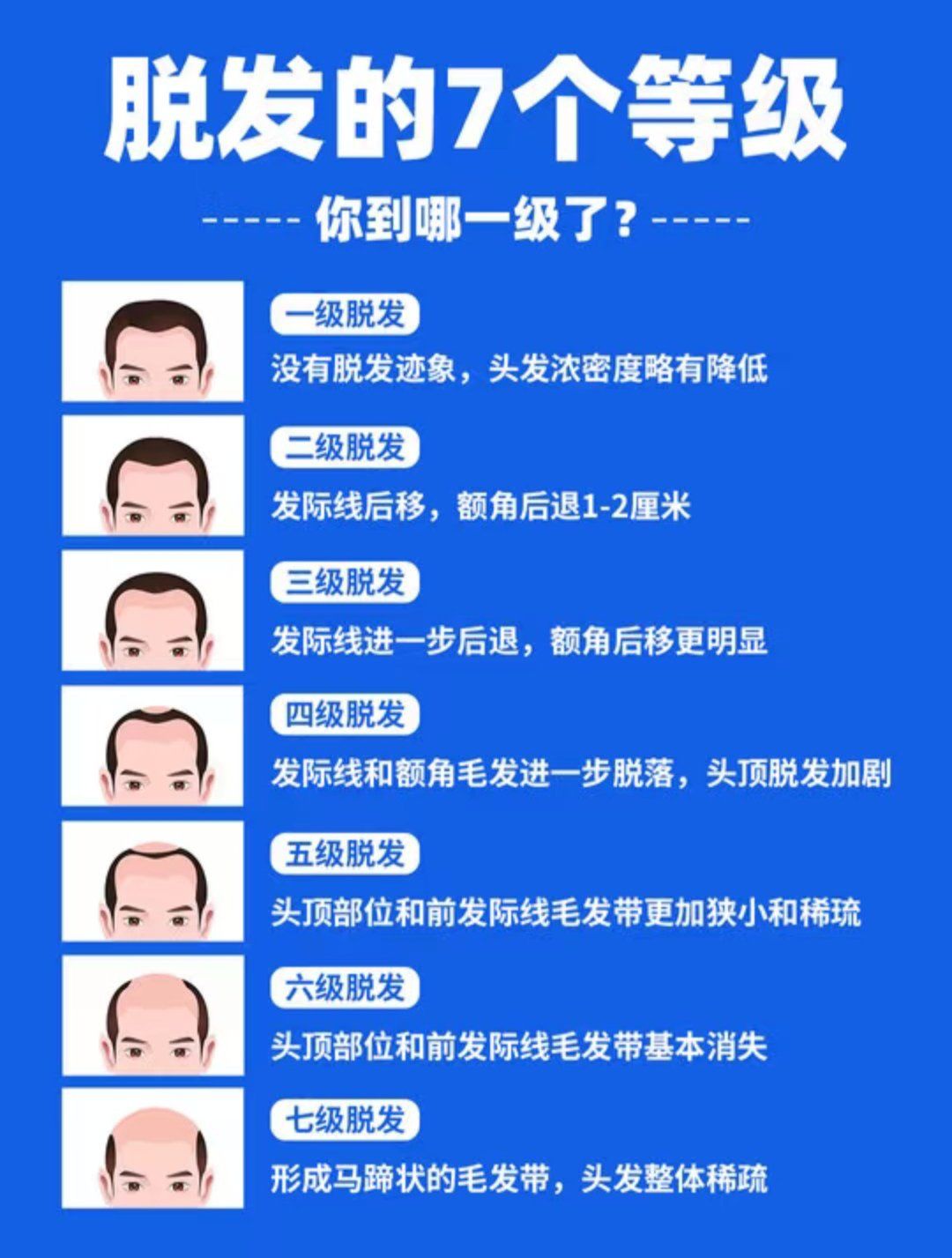 男性脱发等级自测√你处于几级?
现在
