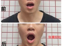 -修申骨雕小颜脊柱骨盆管理产后修复