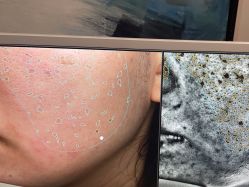 -苑苑vbeauty科技美容SPA