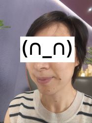 体验后-花隐·美芙炫海菲秀皮肤管理中心