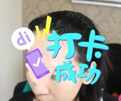 -大麦微针植发全国连锁