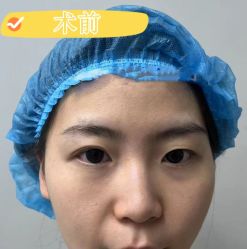 -素美医疗美容·西南眼鼻整形·修复基地