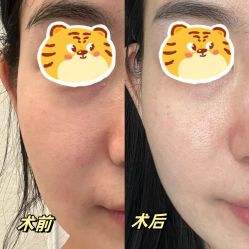 -深圳艺星医疗美容医院
