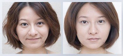 点击看大图 -SKINIST丽铂医疗美容