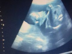 宝宝的超声波照-上海市第七人民医院