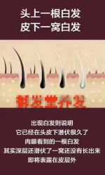 点击看大图 -舒欣头疗·俏丝谧语 白发脱发专业护理