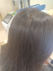 -碧莲盛·不剃发植发