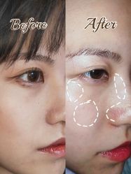 -洁铭新加坡医美