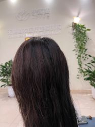 -碧莲盛·不剃发植发