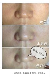 脸部抗衰-光SPA科技美肤