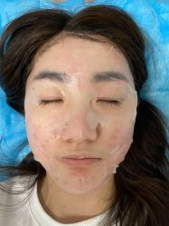 体验后-联合丽格·张菡丽格医疗美容