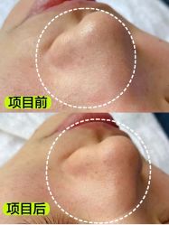 -凡碧诗毛孔清洁收细