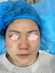 -成都艾特他整形外科医院