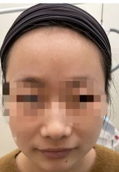 体验后-BR光电保养