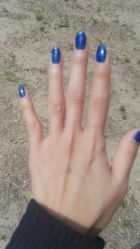 -薇兰专业脱毛连锁机构