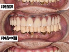 -团圆口腔·种植中心(锦江院区)