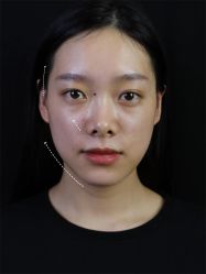 -Yestar重庆艺星医疗美容医院