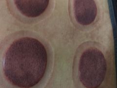 -益友堂盲人推拿正骨穴位按摩工作室