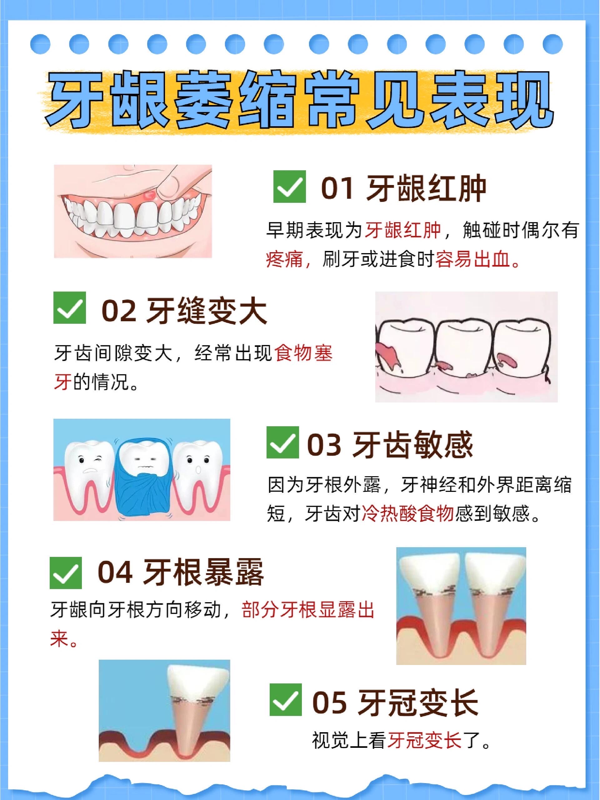 牙龈萎缩怎么回事图片