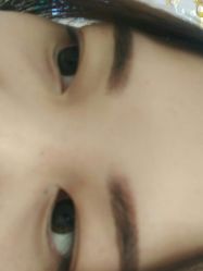 -郡艺医疗美容·微整·眼鼻吸脂