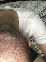 -雍禾植发全国连锁