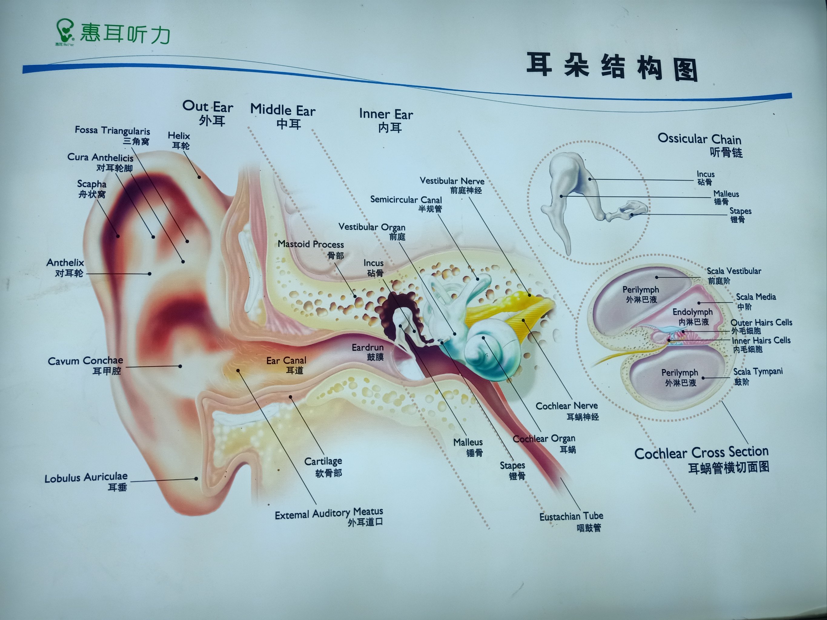 助听器内部结构图图片