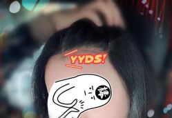 -大麦微针植发全国连锁