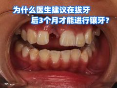 -团圆口腔·种植中心(锦江院区)