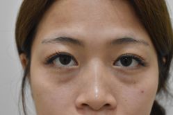 -天津健丽·去眼袋医疗美容机构