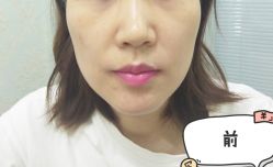-弘美医美·艾维岚童颜抗衰中心