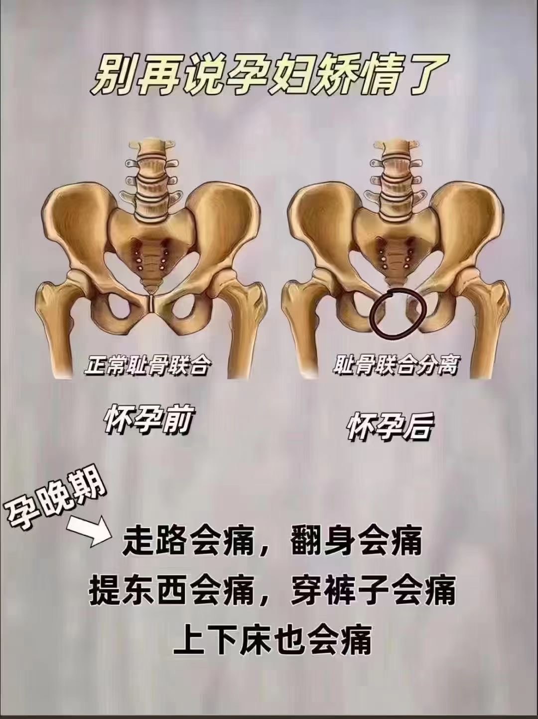 宫腔分离图解图片