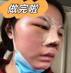 -素美医疗美容·西南眼鼻整形·修复基地