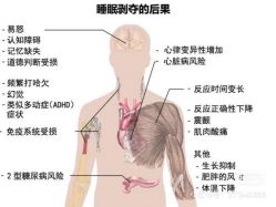 -香薇妮丝女子减肥院