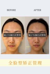 -菊子小颜·日式整骨·产后管理