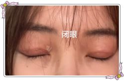 -素美医疗美容·西南眼鼻整形·修复基地