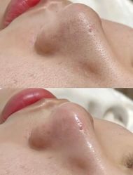 -LUNA皮相美·骨相美高级美感