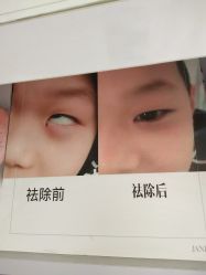 -痣清宫祛斑祛痣连锁店