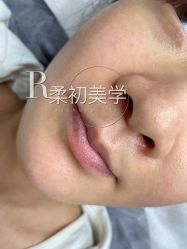 -RC半永久纹眉纹发际线
