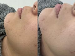 -上置·美兰优湖