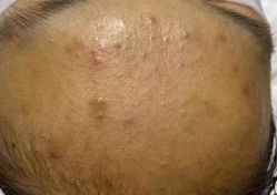 -첫번째 初见美学中心