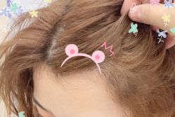 -大麦微针植发全国连锁